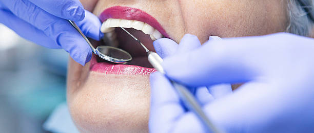 Best Emergency Dental Care for Broken or Chipped Teeth in New Market, VA