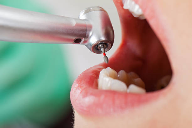 Best Same-Day Emergency Dental Services in New Market, VA